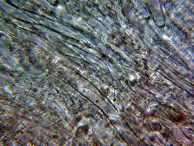 Clavariadelphus truncatus 17 - Hifas contexto 1